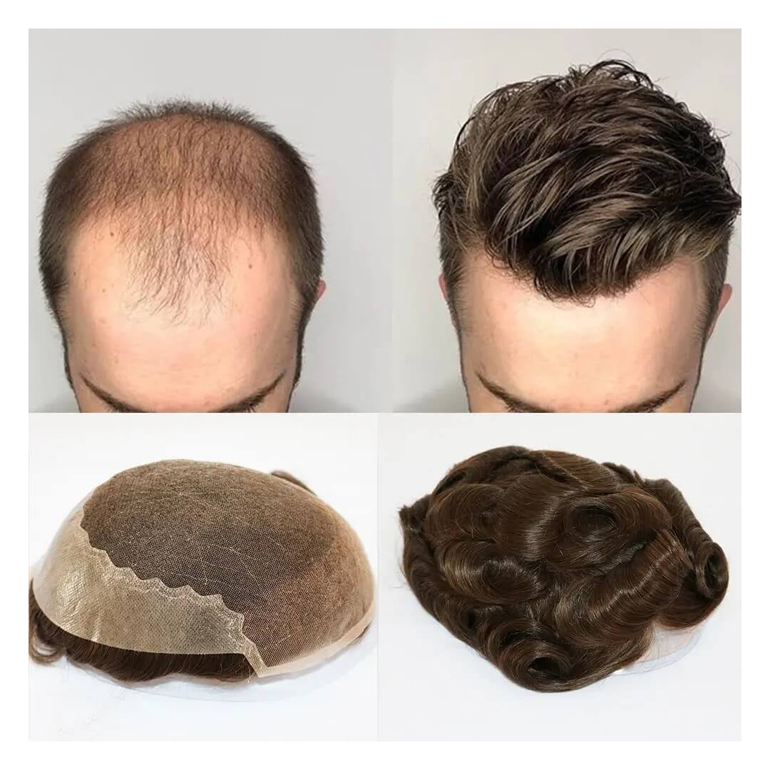 Mantenimiento mensual de prótesis capilar.